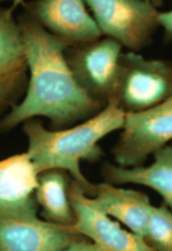 Cell Painting field of U2OS cells from JUMP gene overexpression